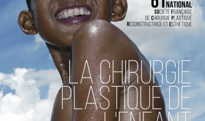 congres national chirurgie plastique
