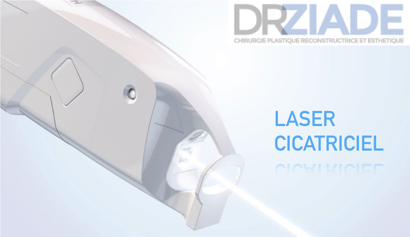 Laser pour cicatrices de chirurgie esthétique